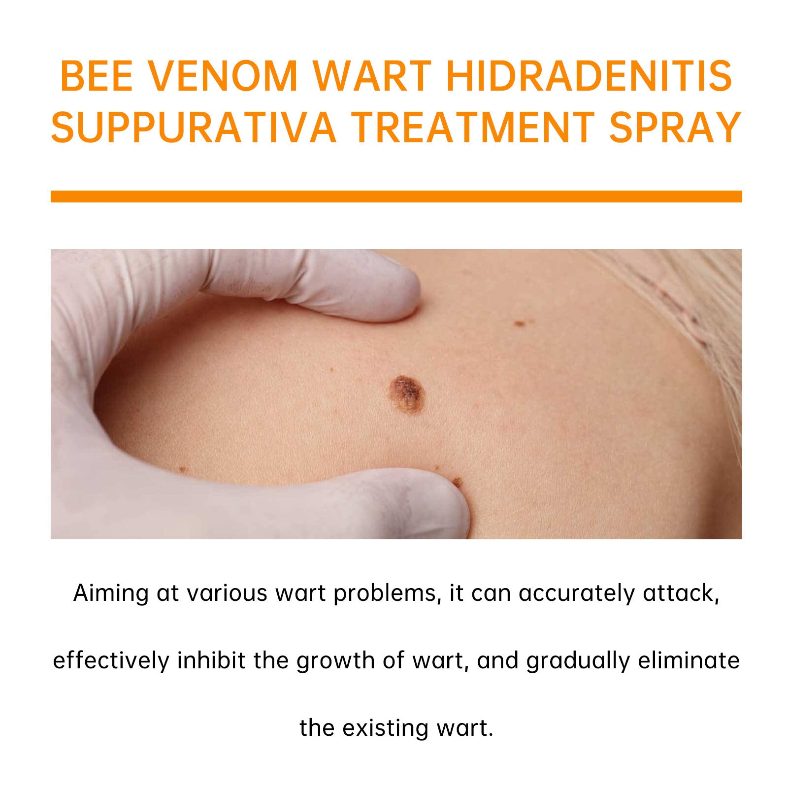 Bee Venom Cures Wart Nursing Spray Cleaning And Desalination