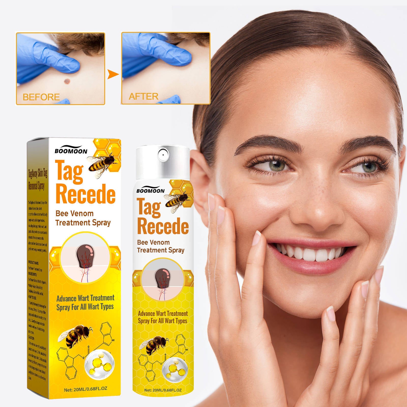 Bee Venom Cures Wart Nursing Spray Cleaning And Desalination