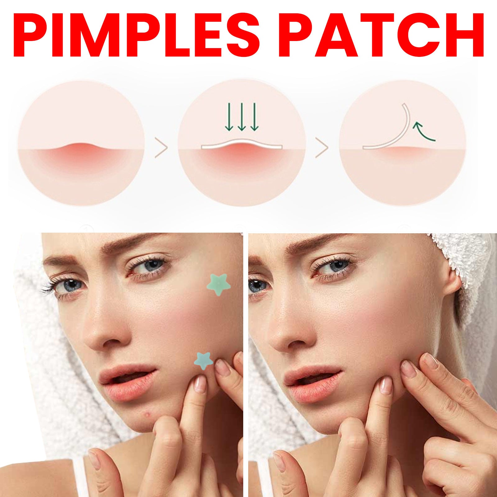 Desalting Pimple Spot Skin Repair Patch