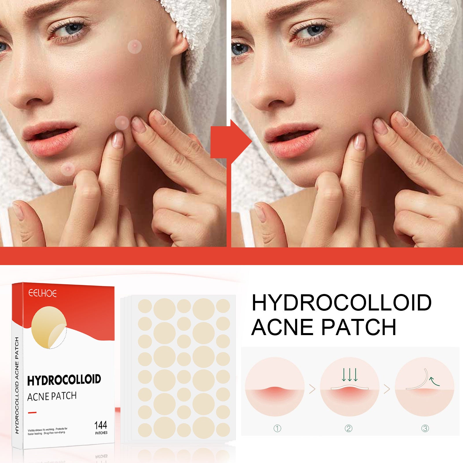 Invisible Breathable Repair Hydrogel Acne Patch