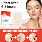 Hydrocolloid Acne Patch Makeup Closed Acne Patch