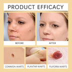 Gentle Cleansing Smooth Body Skin Moisturizing Skin Mole Bee