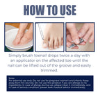 Relieving And Repairing Ingrown Nail Toe Nail Removing Meat Treatment Oil