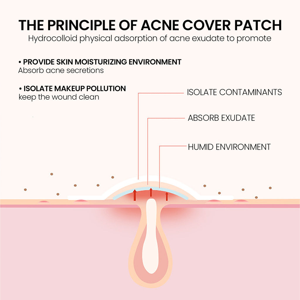 Invisible Hydrocolloid Pimple Patches - Acne Spot Treatment & Blemish Cover