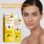 Bee Venom Cures Wart Nursing Spray Cleaning And Desalination