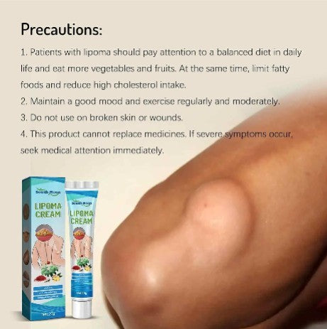 Lipoma Cyst Remover Cream