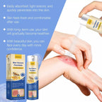 HOUKEA - Bee Venom Psoriasis Soothing Spray