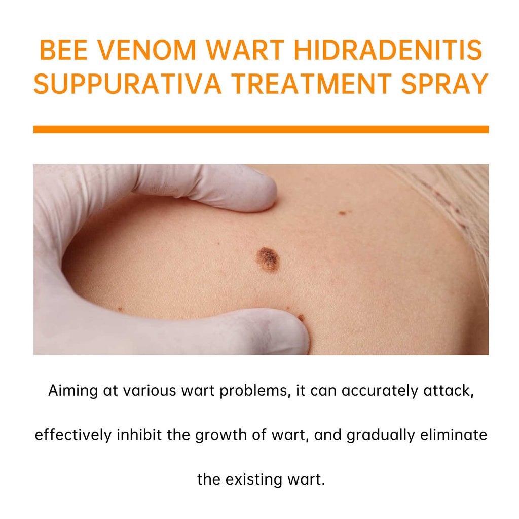 Bee Venom Cures Wart Nursing Spray Cleaning And Desalination