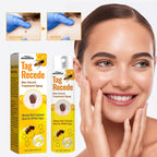 Bee Venom Cures Wart Nursing Spray Cleaning And Desalination