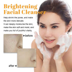 Hoijji Brightening Facial Cleanser, Deep Cleansing Facial Skin, Fades Acne Marks, Moisturizes And Whitens
