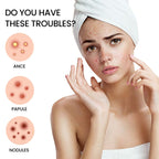 Desalting Pimple Spot Skin Repair Patch