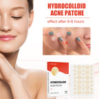 Hydrocolloid Acne Patch Makeup Closed Acne Patch